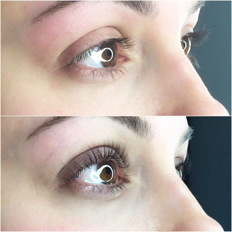 Eyelash and Eyebrow Services  Restore by King Dermatology